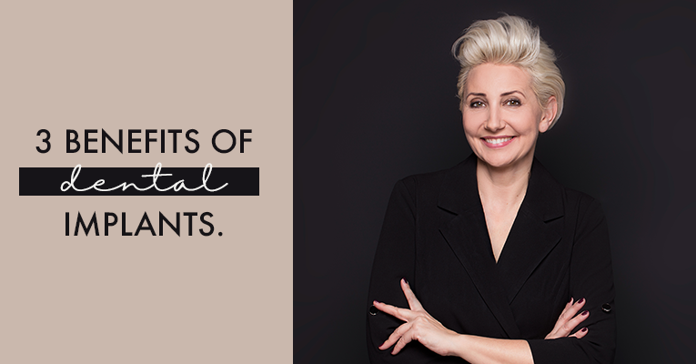 3 Beneficios de los implantes dentales